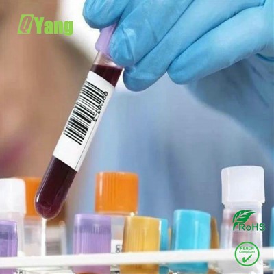 Koje se standardne boje koriste na etiketi vrećice za krv?